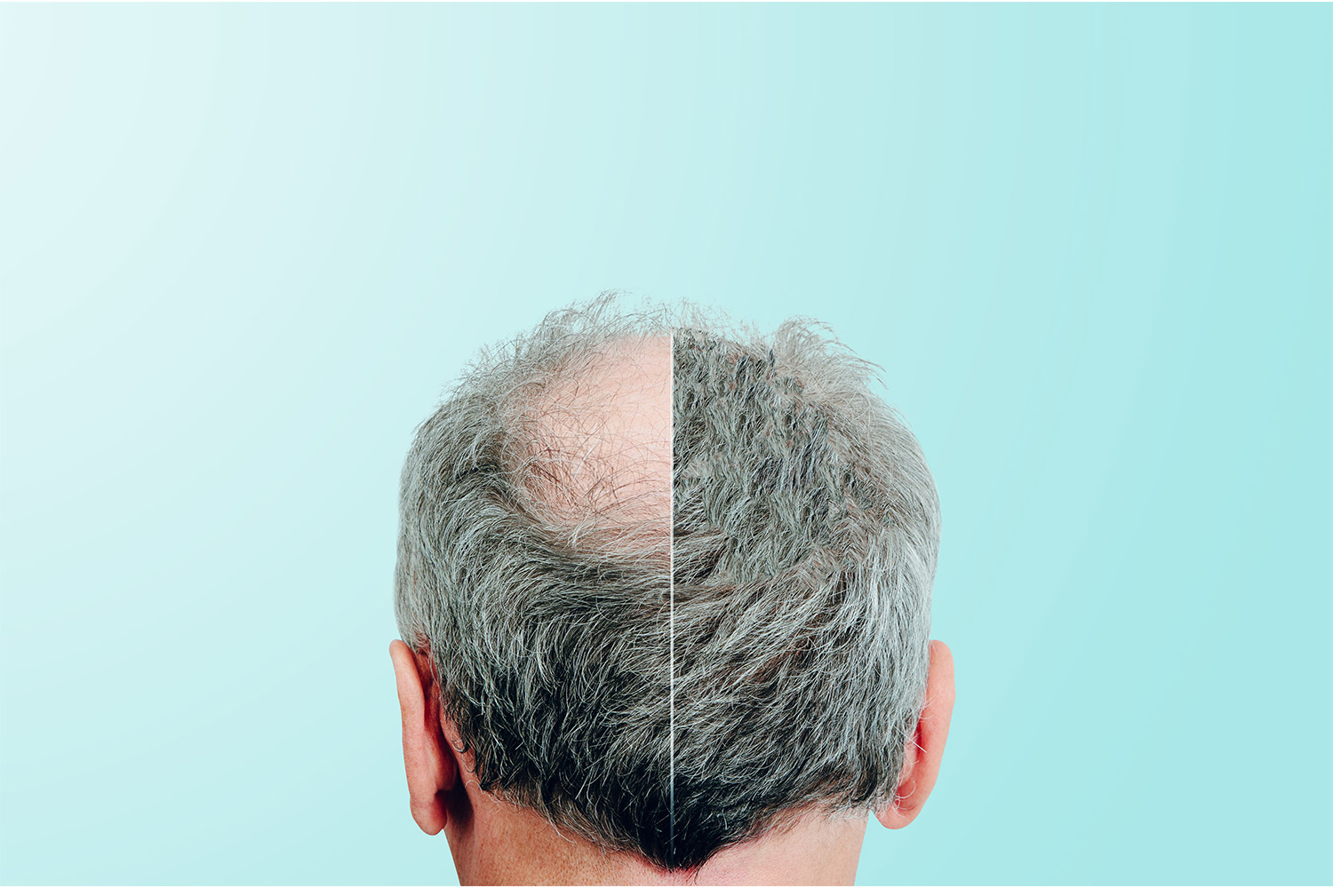 Hair regrowth products