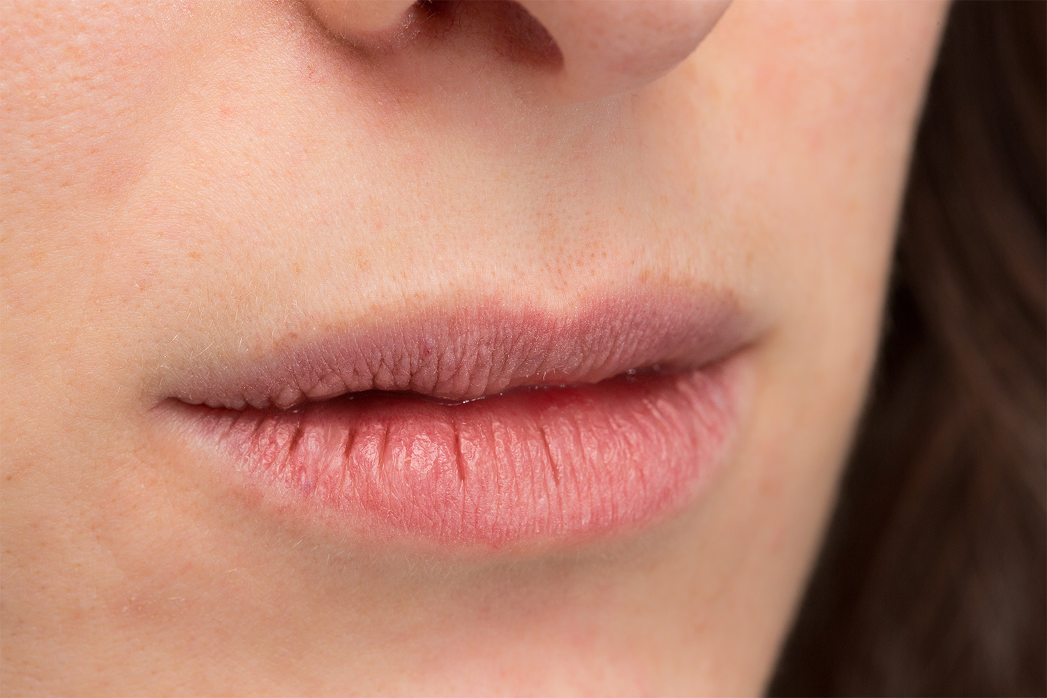 Chapped lips